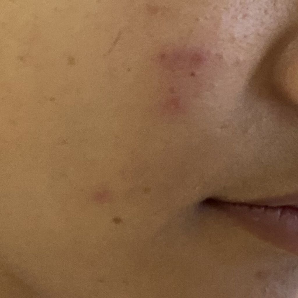 を使ったクチコミ（1枚目）