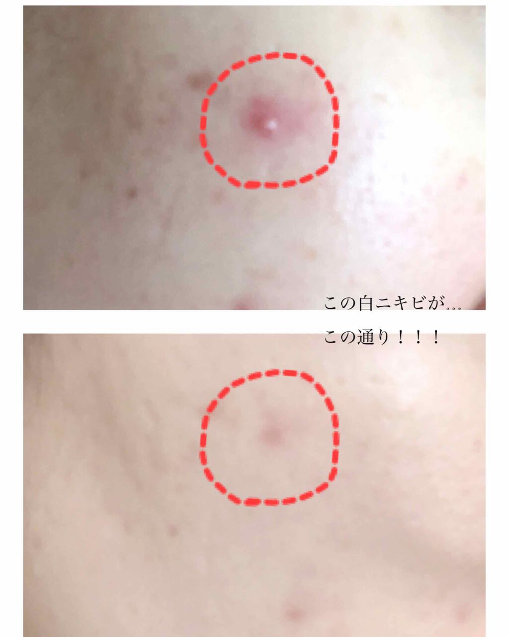 ティーツリーケアソリューション アンプルマスクJEX/MEDIHEAL/シートマスク・パックを使ったクチコミ(4枚目)