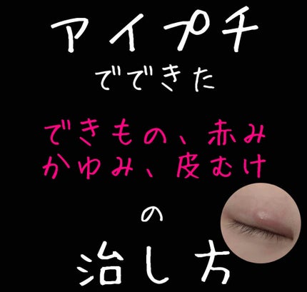 キュアレア(医薬品)/キュアレアa/その他を使ったクチコミ(1枚目)