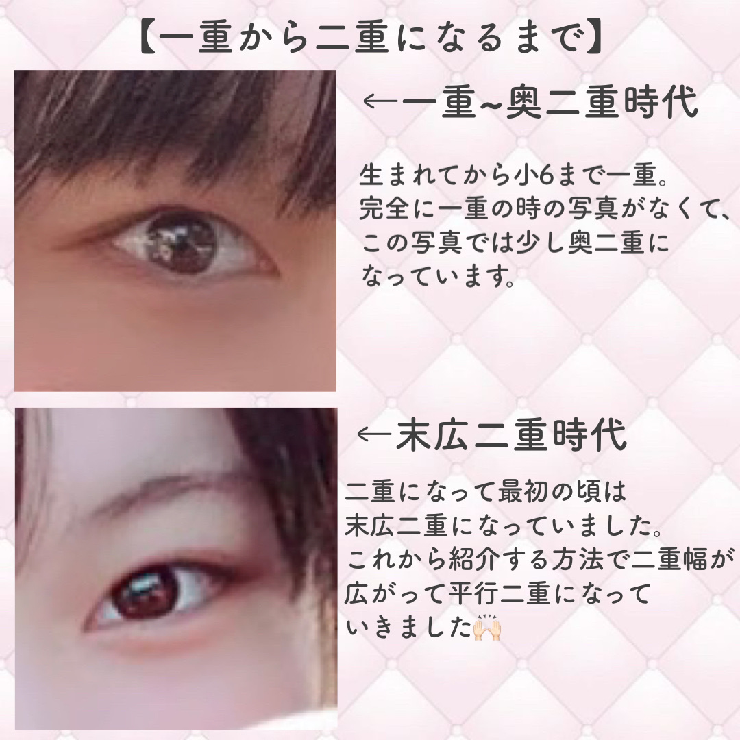 オリジナル ピュアスキンジェリー/ヴァセリン/ボディクリームを使ったクチコミ（2枚目）