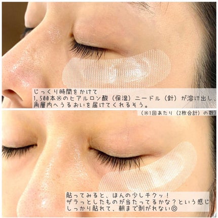 クリアターン ヒアロチューン マイクロパッチ 1500/クリアターン/シートマスク・パックを使ったクチコミ(3枚目)