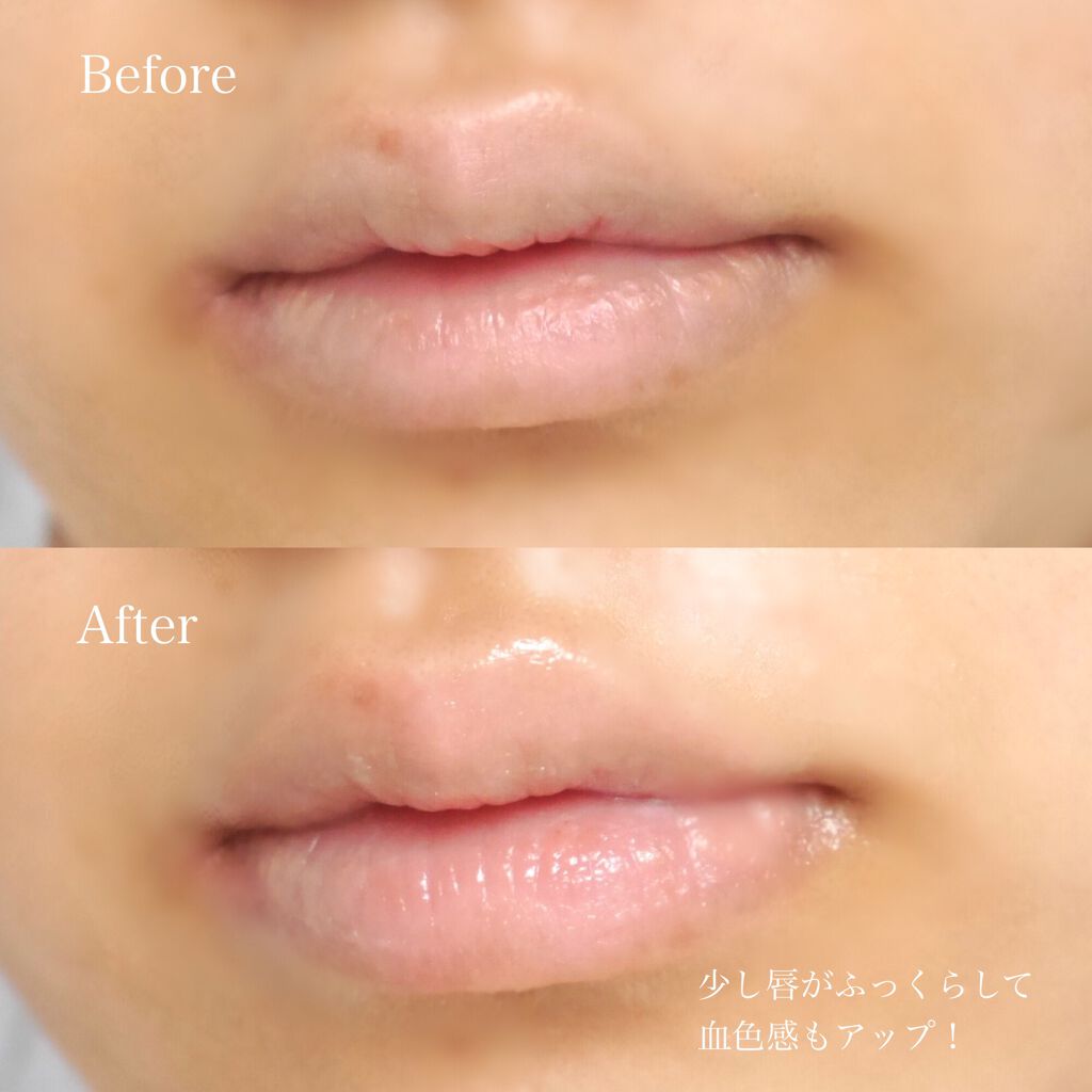 センサイ トータルリップトリートメント/SENSAI/リップ美容液を使ったクチコミ（3枚目）