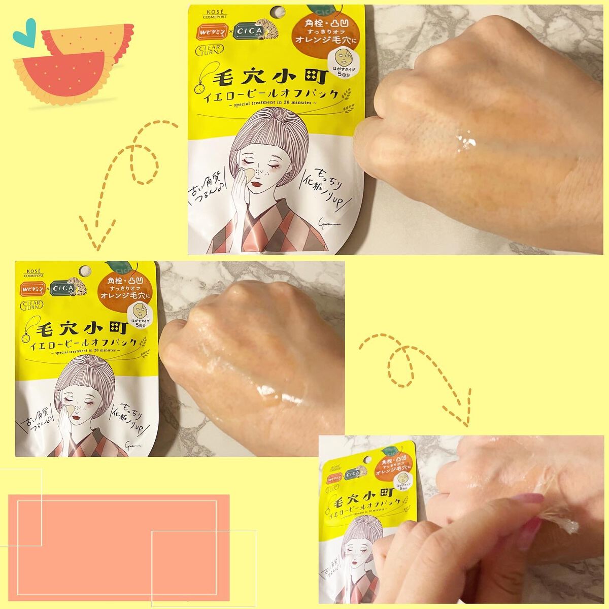 毛穴小町 ブラックピールオフパック/クリアターン/ピーリングを使ったクチコミ(9枚目)