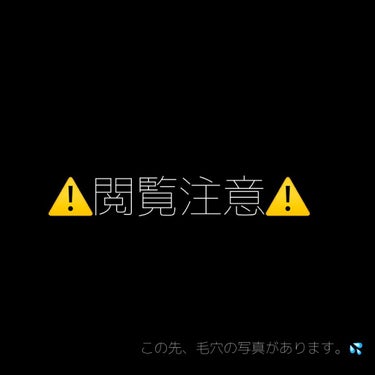 ロゼット洗顔パスタ 海泥スムース/ロゼット/洗顔フォームを使ったクチコミ（1枚目）