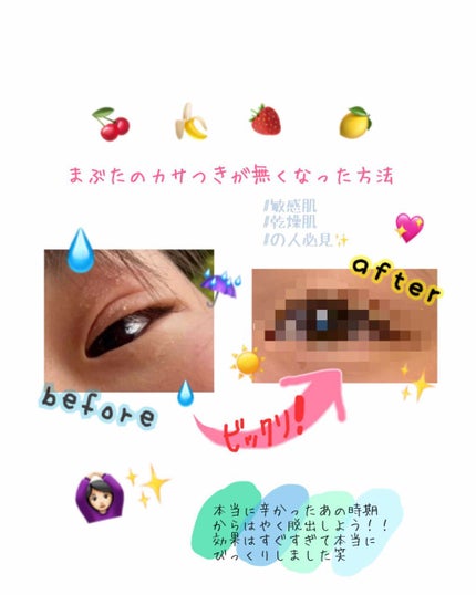 潤浸保湿 乳液/キュレル/乳液を使ったクチコミ(1枚目)