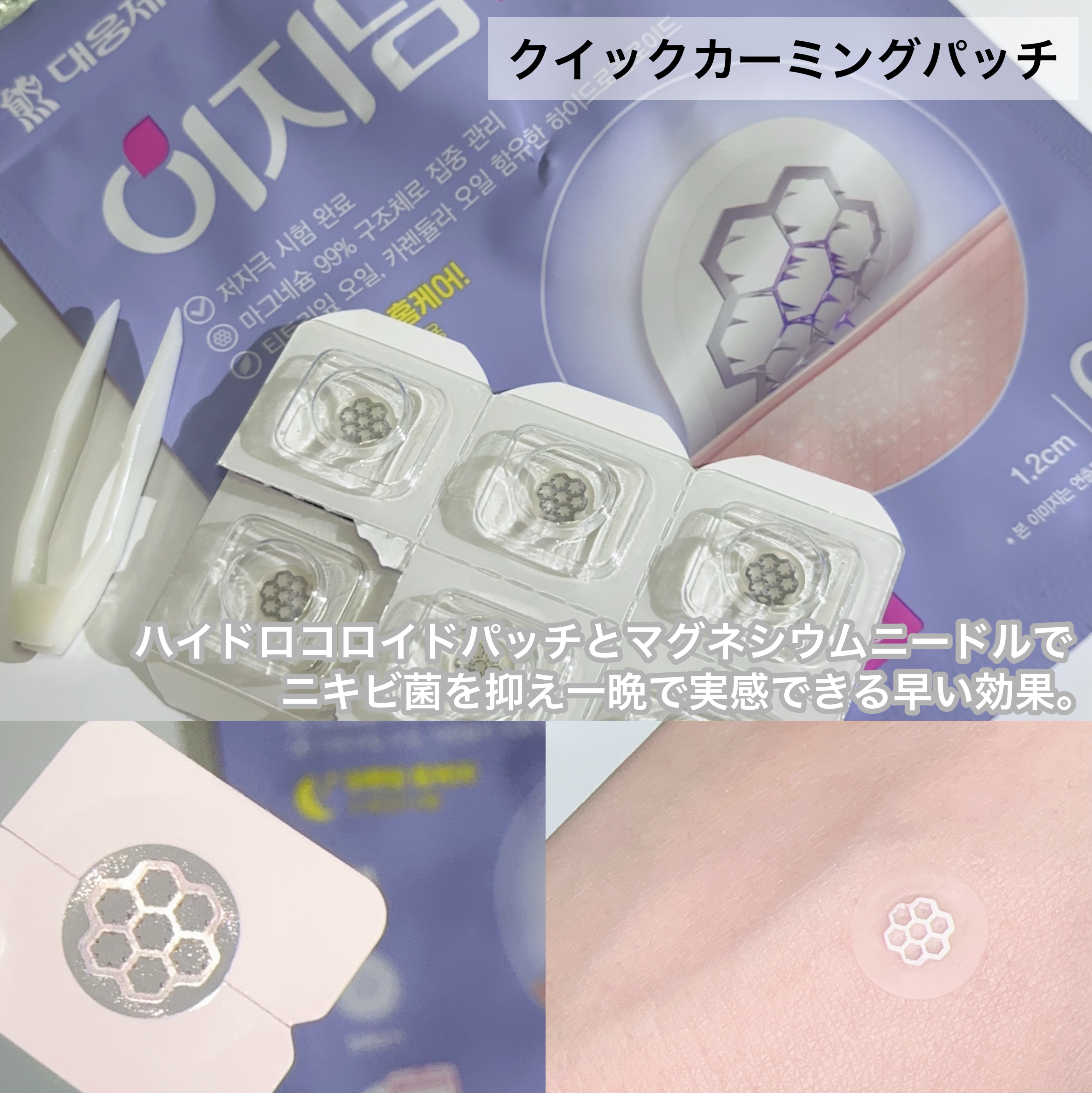 リアルカーミング/イージーダムビューティー/にきびパッチを使ったクチコミ（3枚目）