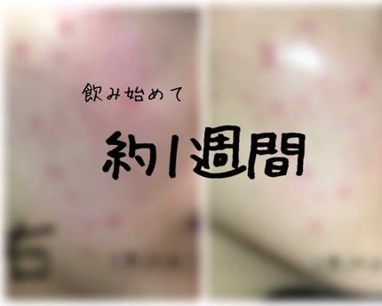 DHC 亜鉛/DHC/健康サプリメントを使ったクチコミ(1枚目)