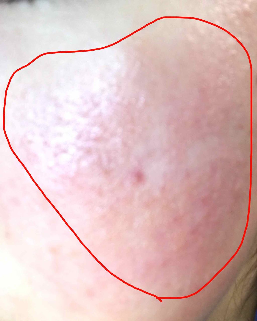 明色美顔水 薬用化粧水/美顔/化粧水を使ったクチコミ（3枚目）