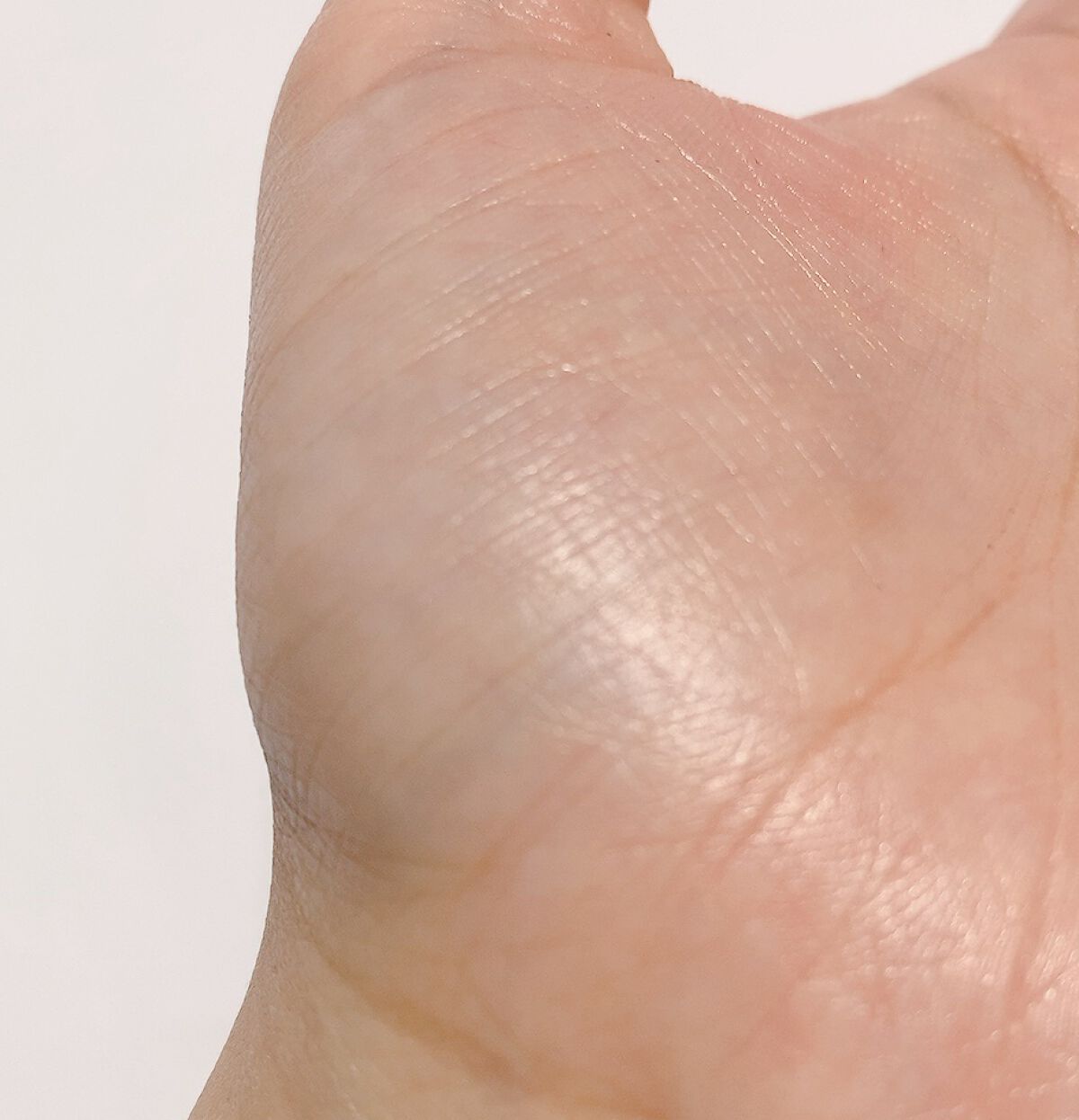 スキンリペアクリーム/d プログラム/フェイスクリームを使ったクチコミ(8枚目)