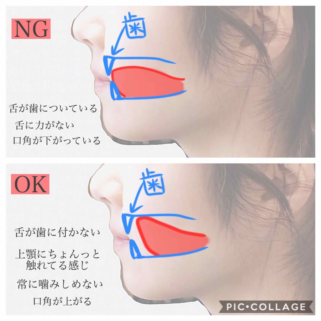 ムンユ on LIPS 「顔面はいくらだって変わる!〜2年弱で20年のコンプレックスを払..」(3枚目)