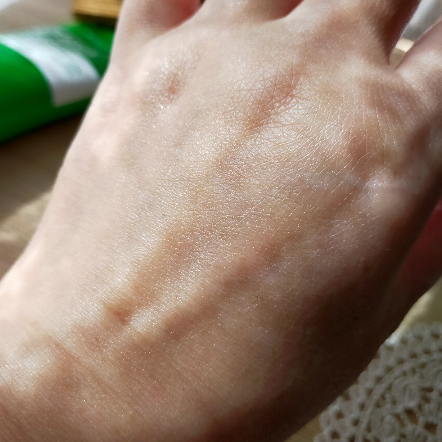 A-Control 10%アゼライックアシッドセラム/NINELESS/美容液を使ったクチコミ(5枚目)