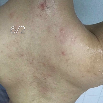 セナキュア(医薬品)/小林製薬/その他を使ったクチコミ(3枚目)