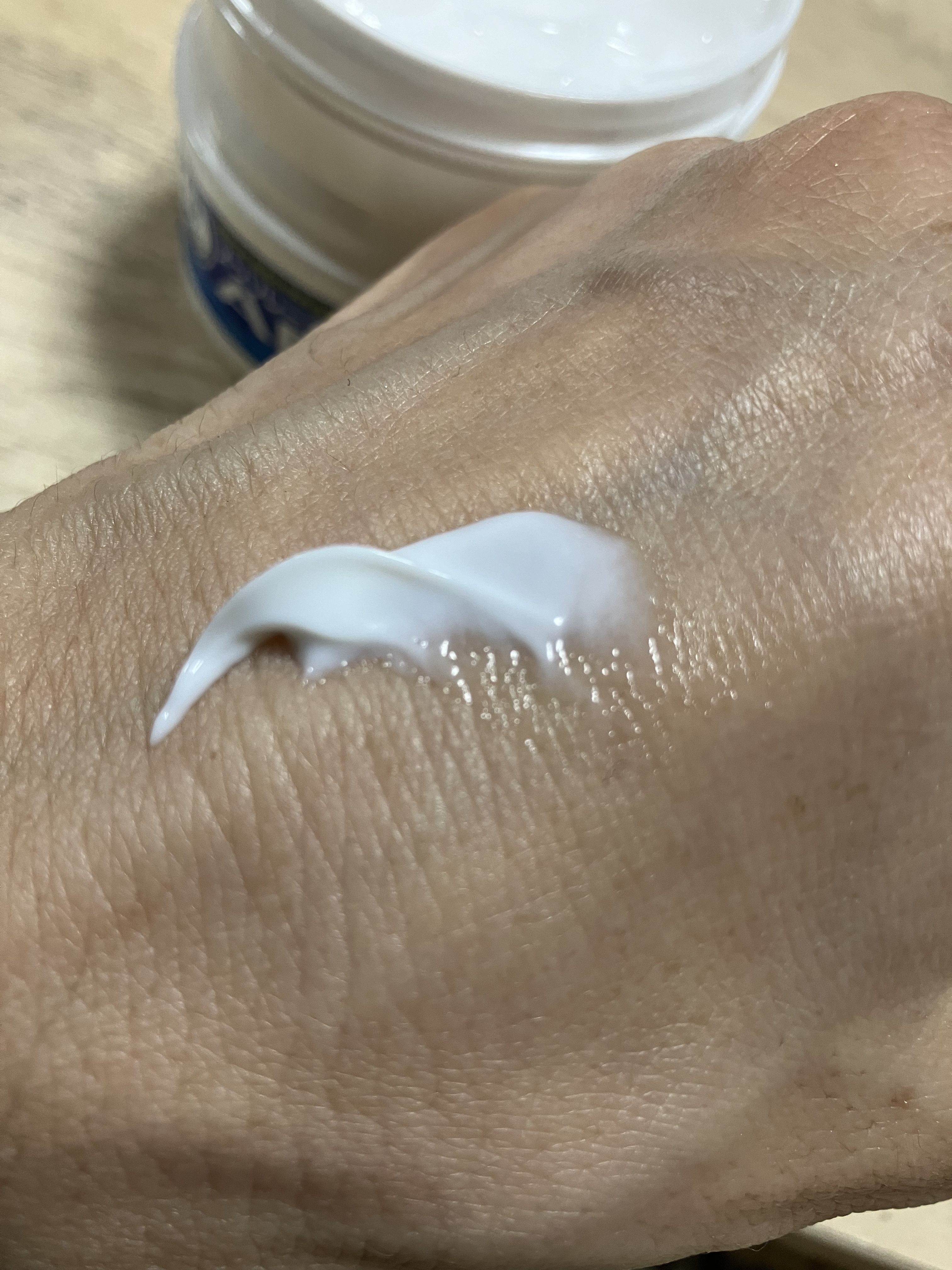 メンソレータムADクリームm(医薬品)/メンソレータムAD/その他を使ったクチコミ（3枚目）