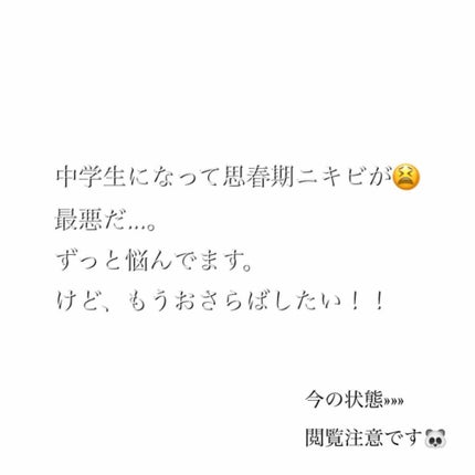 明色美顔水 薬用化粧水/美顔/化粧水を使ったクチコミ(2枚目)