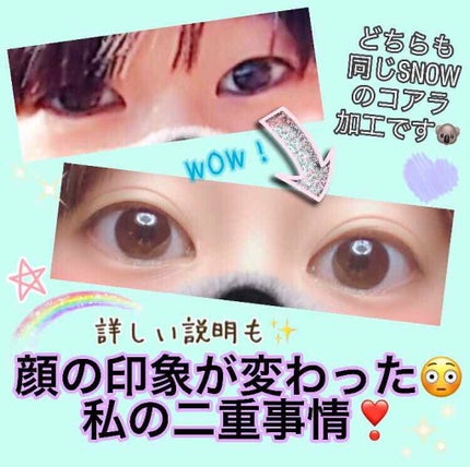 ふたえテープ 目立たず肌になじむ絆創膏タイプ/DAISO/二重まぶた用アイテムを使ったクチコミ(1枚目)