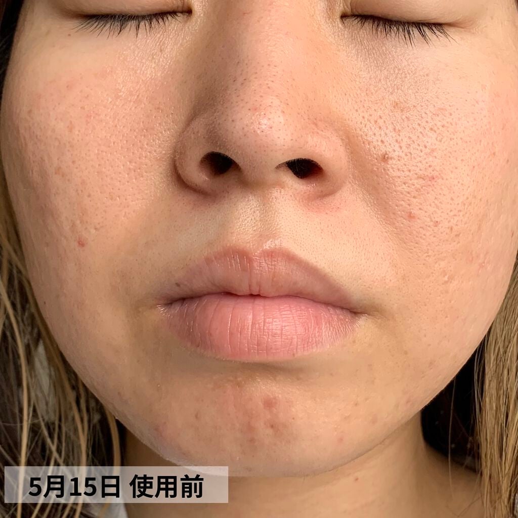 PURE ROSEHIP SEED OIL/Life-flo/フェイスオイルを使ったクチコミ(7枚目)