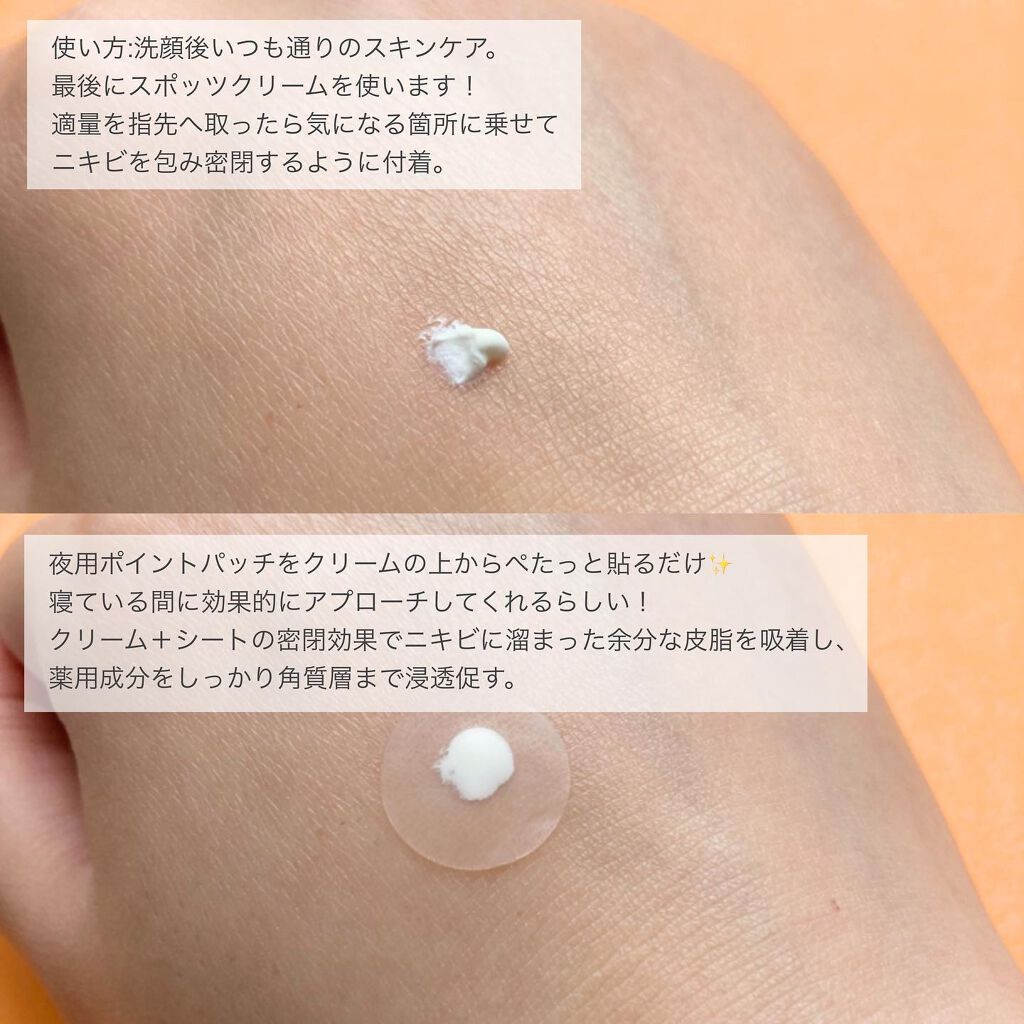 薬用ニキビケア スポッツクリーム/アクネスラボ/フェイスクリームを使ったクチコミ（3枚目）