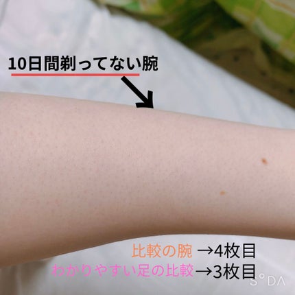 光脱毛器 VIO/Sarlisi/家庭用脱毛器を使ったクチコミ(2枚目)