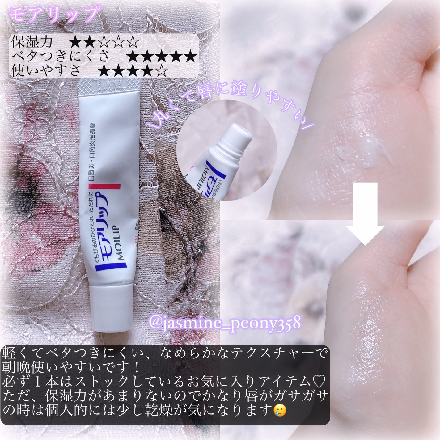 ヒビプロLP(医薬品)/メンソレータム/その他を使ったクチコミ(2枚目)