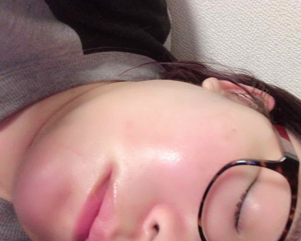 リンクルリペア エマルジョン/ルシェリ/乳液を使ったクチコミ（2枚目）