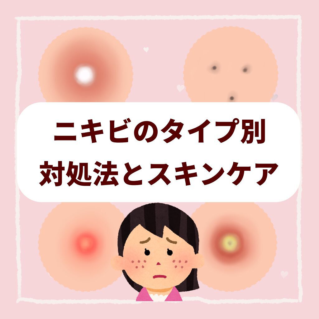 明色美顔水 薬用化粧水/美顔/化粧水を使ったクチコミ(1枚目)