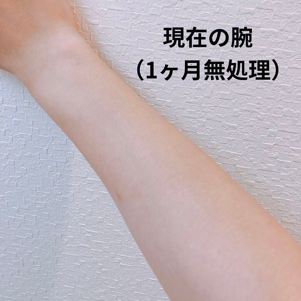 光美容器 光エステ <ボディ&フェイス用> ES-WP81/Panasonic/家庭用脱毛器を使ったクチコミ(4枚目)