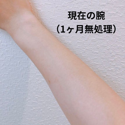 光美容器 光エステ <ボディ&フェイス用> ES-WP81/Panasonic/家庭用脱毛器を使ったクチコミ(4枚目)