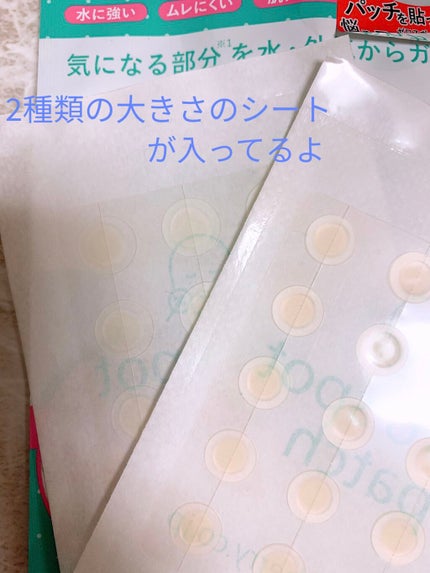 ゼロスポットパッチ/Today’s Cosme/にきびパッチを使ったクチコミ(2枚目)