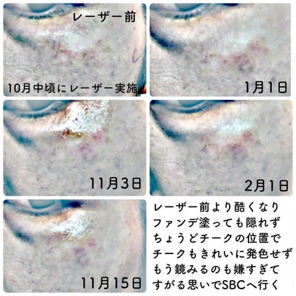 SBC ナノメソッドHQ/SBC/フェイスクリームを使ったクチコミ(7枚目)