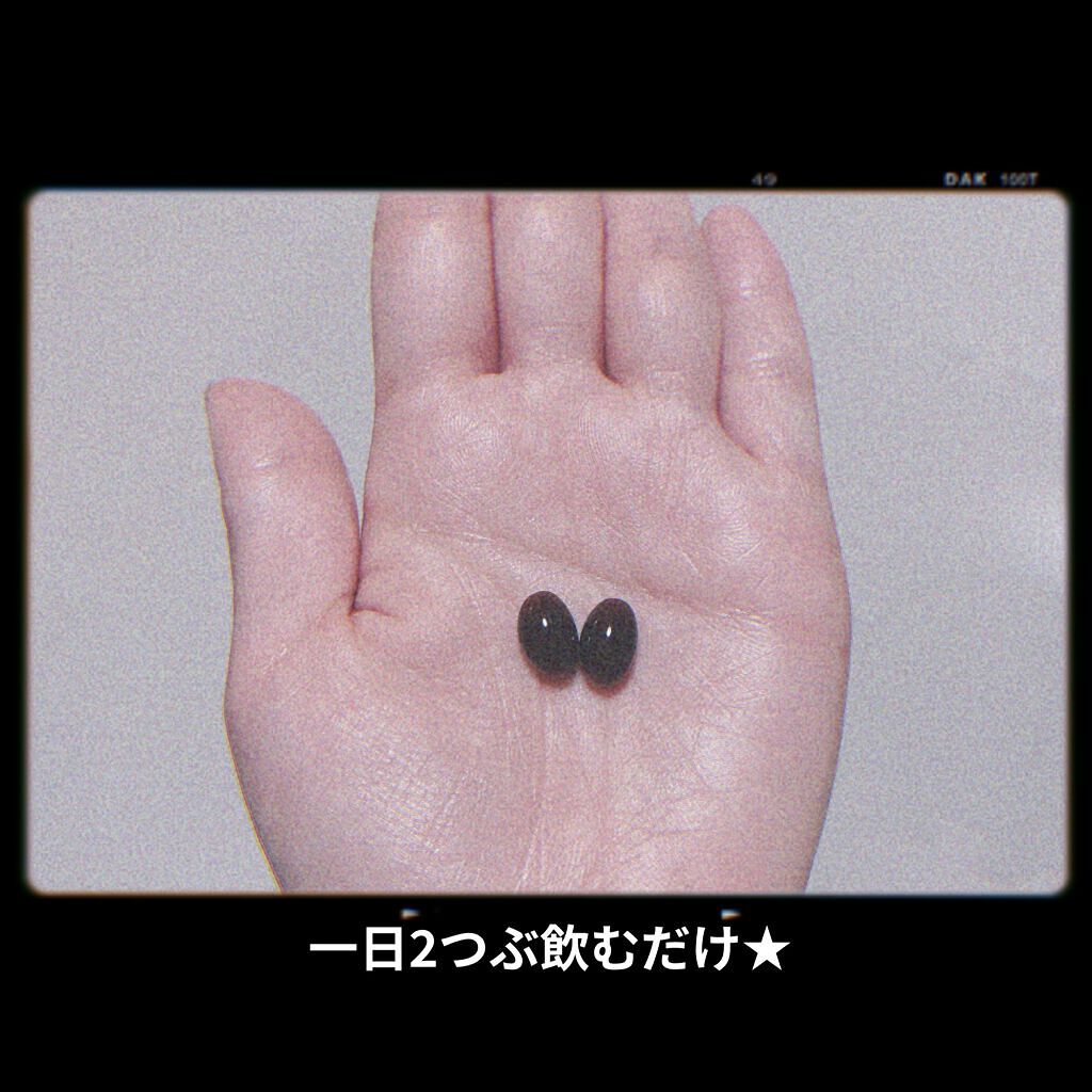 WHITE CERAMIDE ASTAPLUS/B/H COLLECT/美容サプリメントを使ったクチコミ（2枚目）