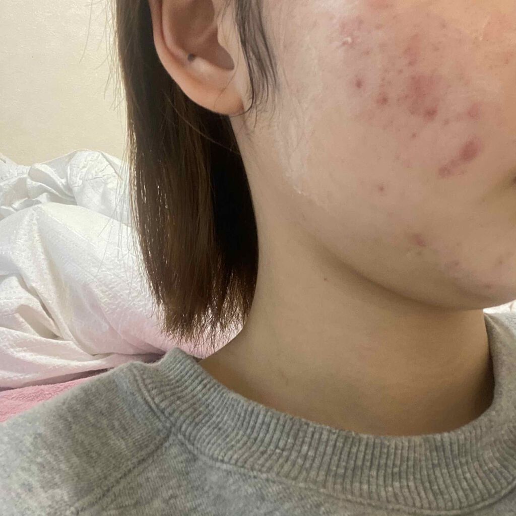 を使ったクチコミ（1枚目）