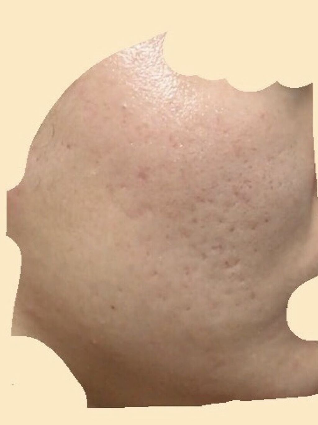 ハトムギ化粧水(ナチュリエ スキンコンディショナー R )/ナチュリエ/化粧水を使ったクチコミ（3枚目）