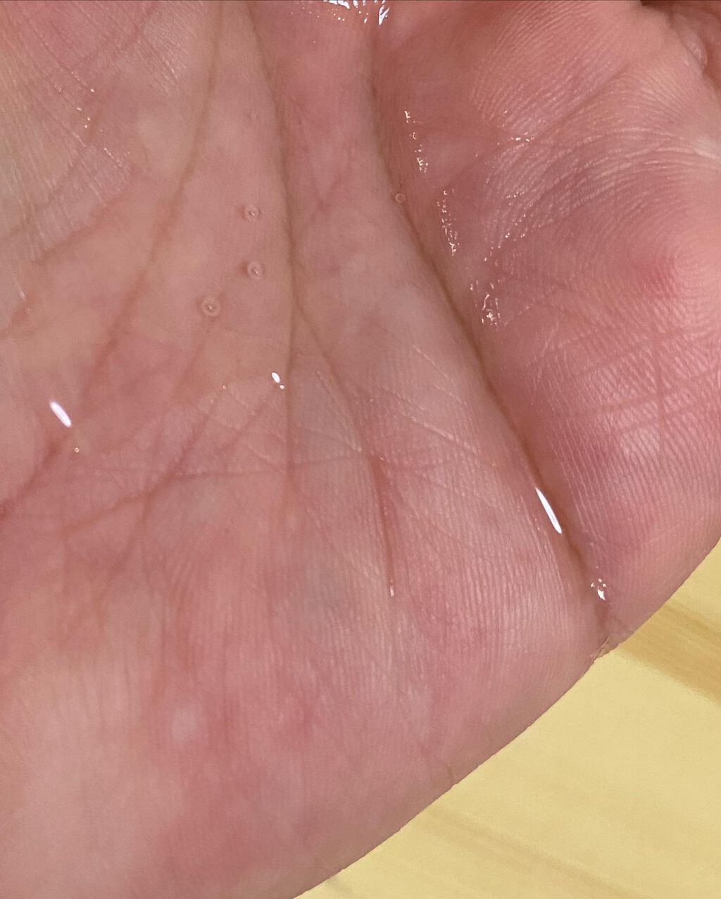 オルビスユー ローション/オルビス/化粧水を使ったクチコミ（3枚目）