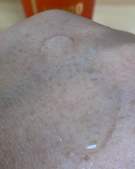 VC100エッセンスローション EX/ドクターシーラボⓇ/化粧水を使ったクチコミ(4枚目)