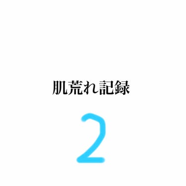 十味敗毒湯 ジュウミハイドクトウ(医薬品)/クラシエ薬品/その他を使ったクチコミ（1枚目）