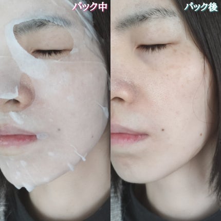 MOIST CHARGE C MASK /PANACEE TOKYO/シートマスク・パックを使ったクチコミ(6枚目)