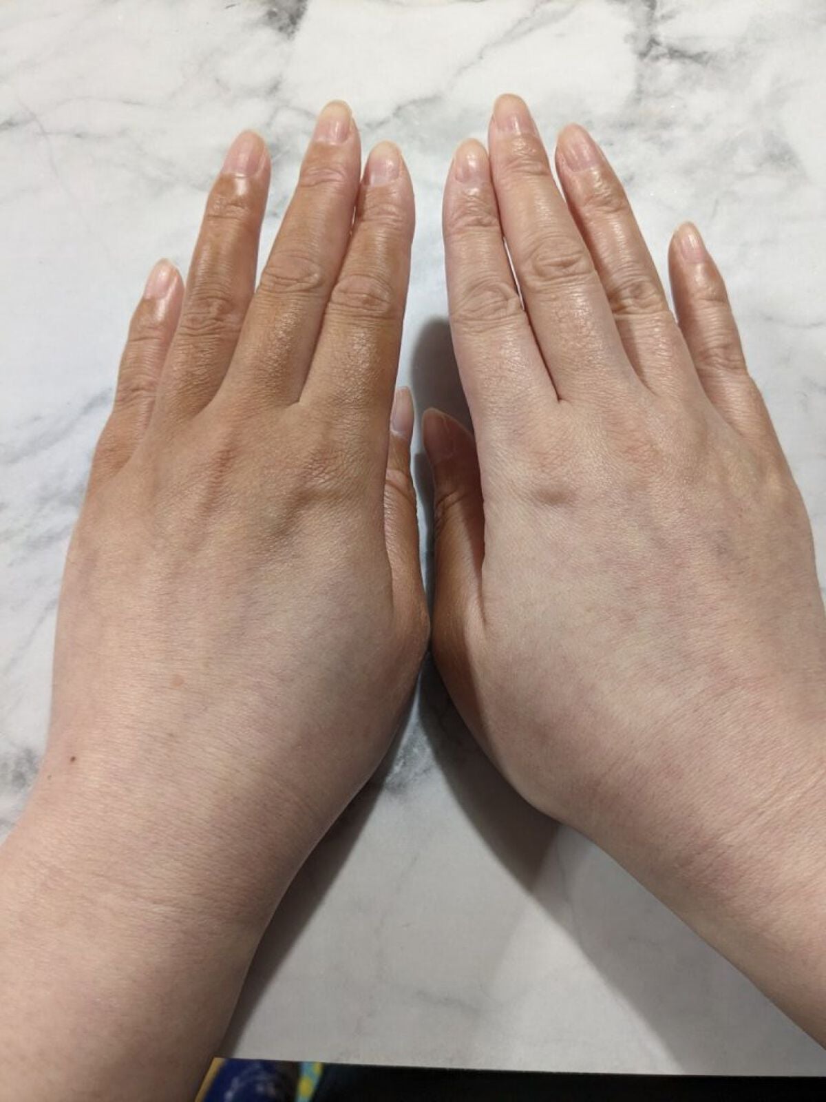 ピュアショット エッセンス ローション/YVES SAINT LAURENT BEAUTE/化粧水を使ったクチコミ(6枚目)