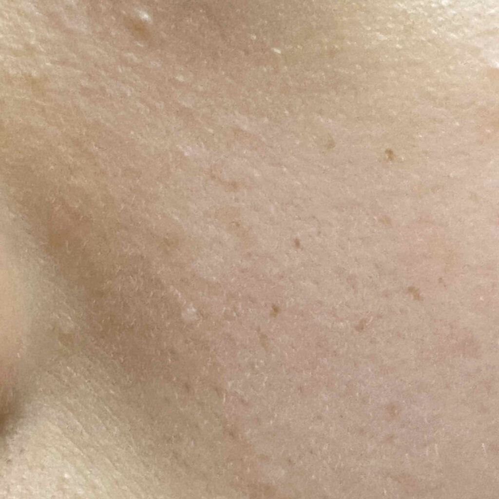 ハトムギ化粧水(ナチュリエ スキンコンディショナー R )/ナチュリエ/化粧水を使ったクチコミ(3枚目)