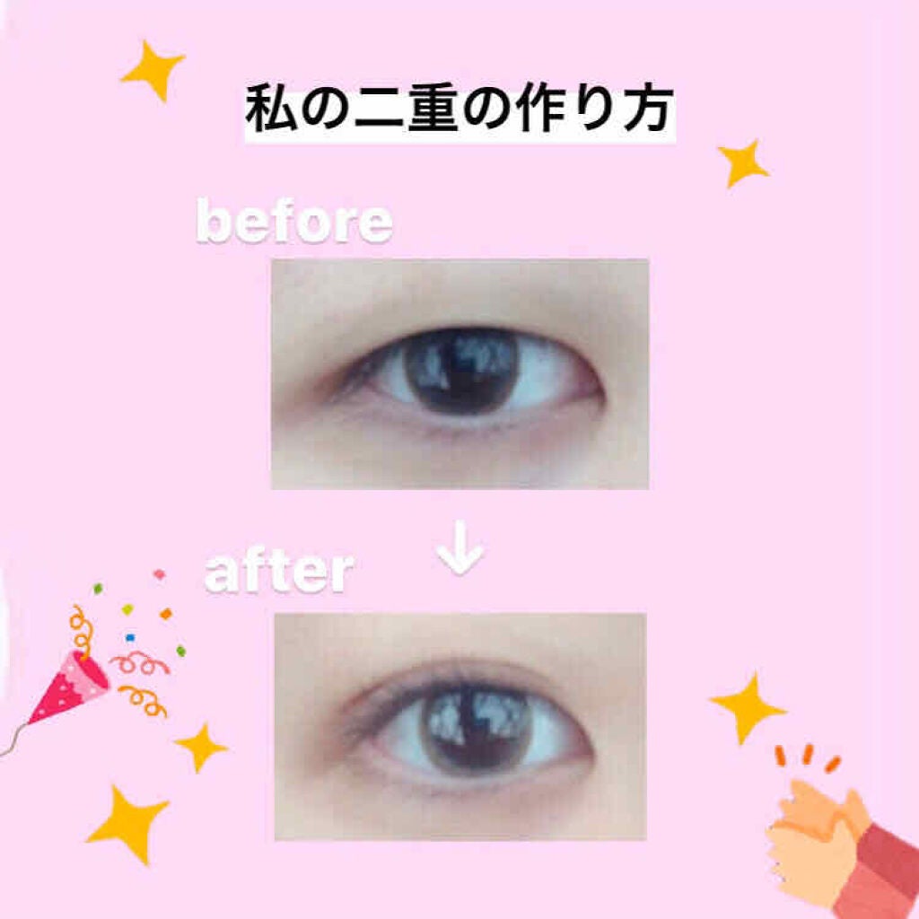 エムズワン 救急バン 徳用 半透明タイプ Mサイズ(100枚)/M's one/その他を使ったクチコミ(1枚目)