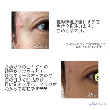 ビフィダバイオームコンプレックスセラム/manyo/美容液を使ったクチコミ(3枚目)