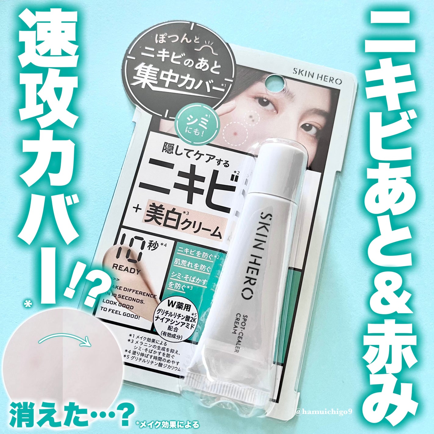 薬用スポットシーラークリーム/スキンヒーロー/クリームコンシーラーを使ったクチコミ(1枚目)