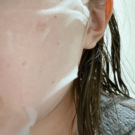 ダーマレーザー スーパーNMN100マスク/クオリティファースト/シートマスク・パックを使ったクチコミ(3枚目)