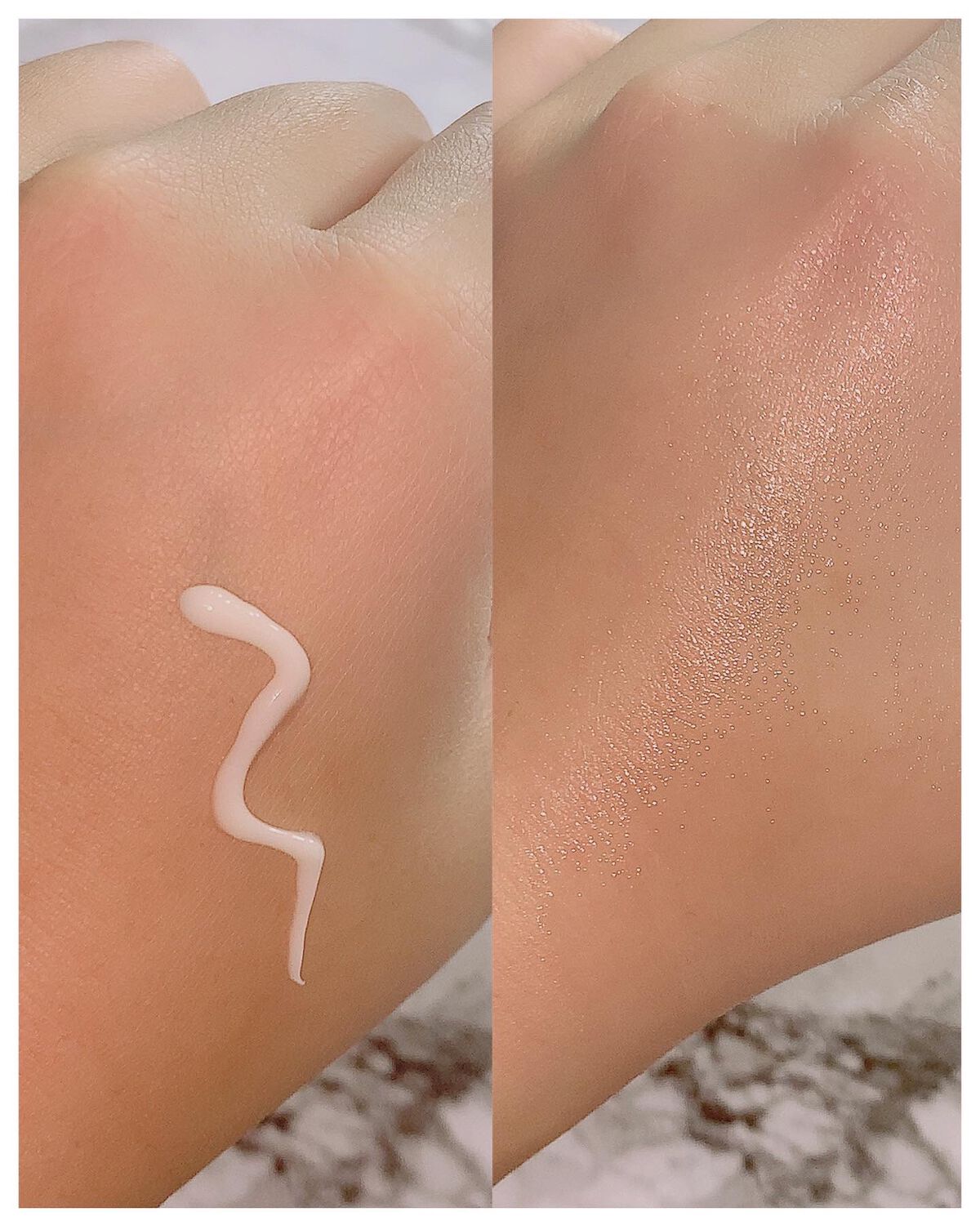 シカレチA エッセンス0.1/VT/美容液を使ったクチコミ（3枚目）