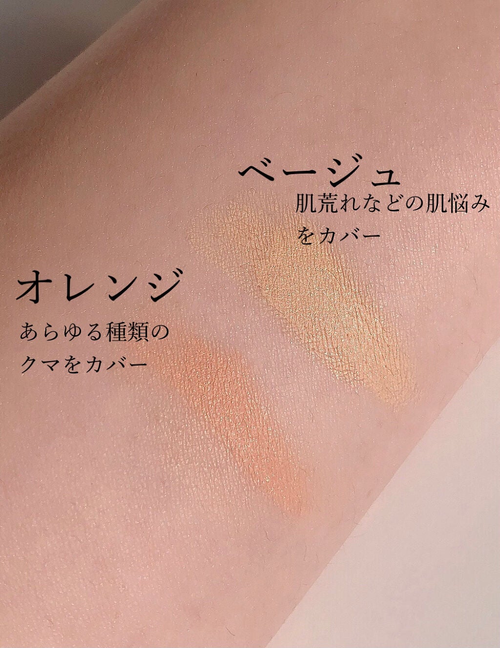 UVãã«ã¯/ïŒbe/æ¥çŒãæ¢ãã»UVã±ã¢ã䜿ã£ãã¯ãã³ãïŒ5æç®ïŒ