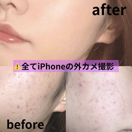 ダブル ウェア ステイ イン プレイス メークアップ /ESTEE LAUDER/リキッドファンデーションを使ったクチコミ(1枚目)