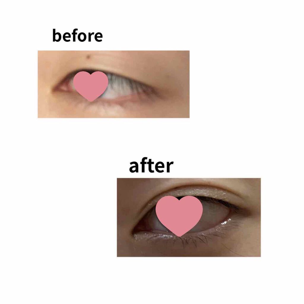 メッシュ アイテープ/shefun/二重まぶた用アイテムを使ったクチコミ(2枚目)