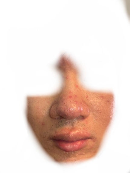 CICA デイリースージングマスク/VT/シートマスク・パックを使ったクチコミ(2枚目)