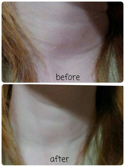 ネックエステミスト/北の快適工房/ネック・デコルテケアを使ったクチコミ(4枚目)