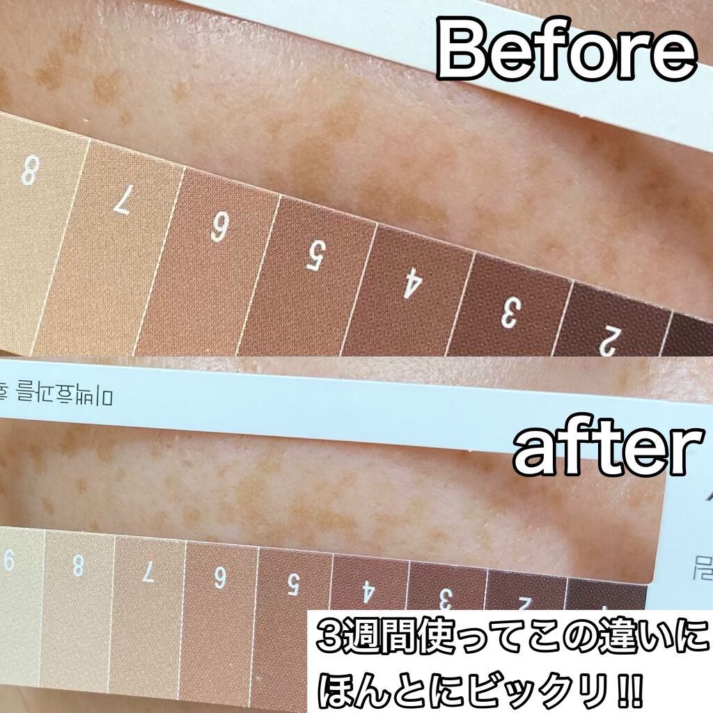 GIMIYA 美白アンプルセット/TONYMOLY/美容液を使ったクチコミ(5枚目)