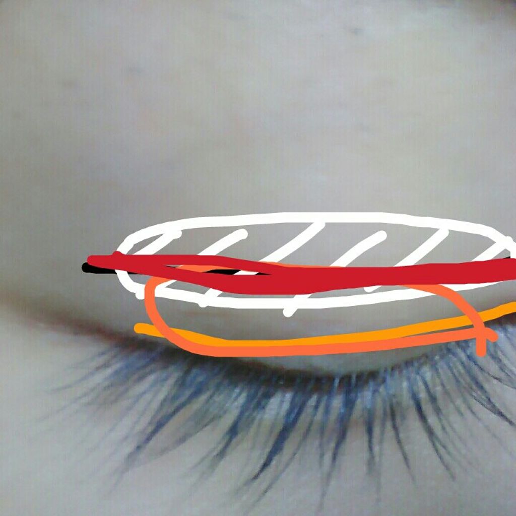 アイトーク/アイトーク/二重まぶた用アイテムを使ったクチコミ（3枚目）